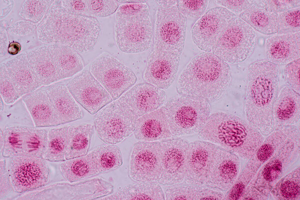 Mitosis cell in the Root tip of Onion under a microscope.