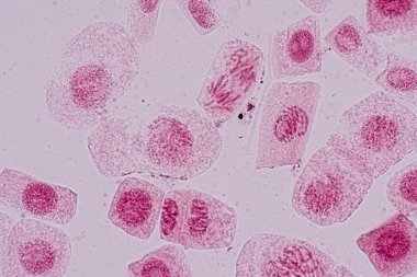 Mitosis cell in the Root tip of Onion under a microscope.