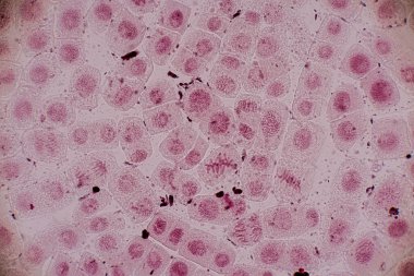 Mitosis cell in the Root tip of Onion under a microscope.
