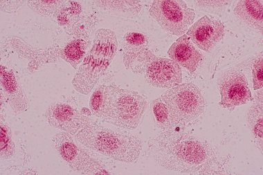 Mitosis cell in the Root tip of Onion under a microscope.