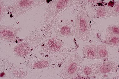 Mitosis cell in the Root tip of Onion under a microscope.