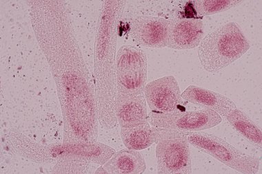 Mitosis cell in the Root tip of Onion under a microscope.