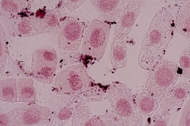 Mitosis cell in the Root tip of Onion under a microscope.