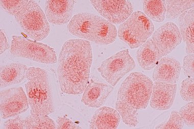 Mitosis cell in the Root tip of Onion under a microscope.