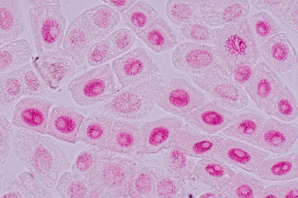 Mitosis cell in the Root tip of Onion under a microscope.
