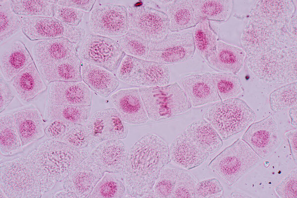 Mitosis cell in the Root tip of Onion under a microscope.
