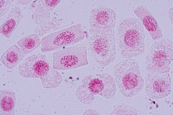 Mitosis cell in the Root tip of Onion under a microscope.