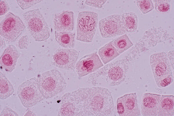 Mitosis cell in the Root tip of Onion under a microscope.