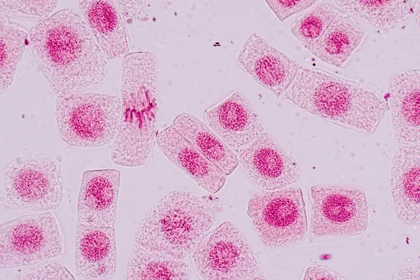 Mitose Cel Wortelpunt Van Onder Een Microscoop — Stockfoto