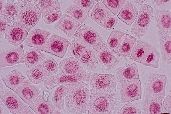 Mitosezelle Der Wurzelspitze Der Zwiebel Unter Dem Mikroskop — Stockfoto