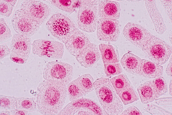 Mitosis cell in the Root tip of Onion under a microscope.
