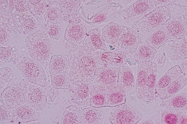 Mitosis cell in the Root tip of Onion under a microscope.