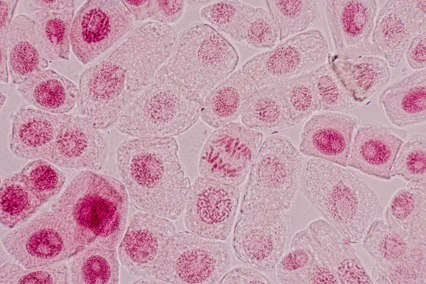 Клетки Митоза Кончике Корня Лука Микроскопом — стоковое фото