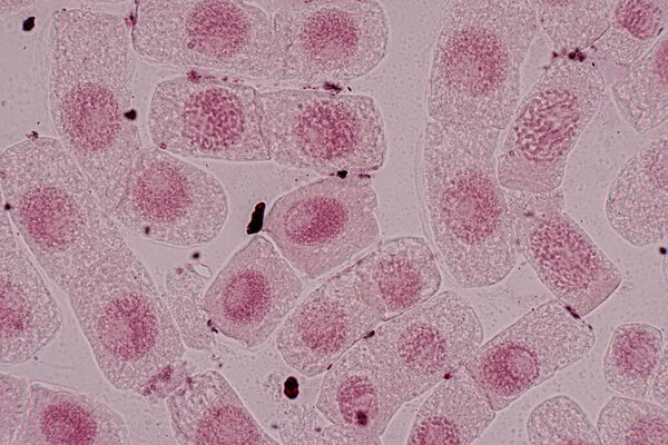Mitosis cell in the Root tip of Onion under a microscope.