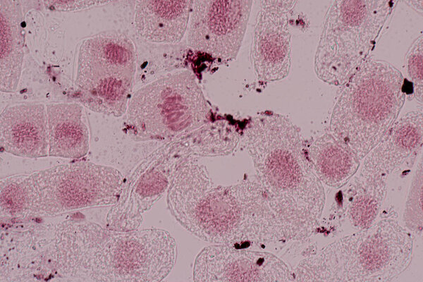 Mitosis cell in the Root tip of Onion under a microscope.