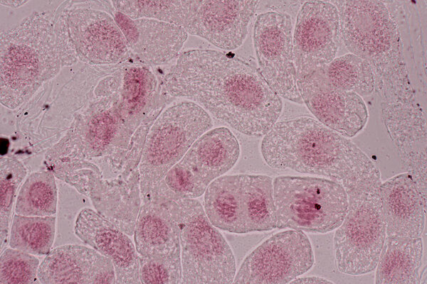 Mitosis cell in the Root tip of Onion under a microscope.