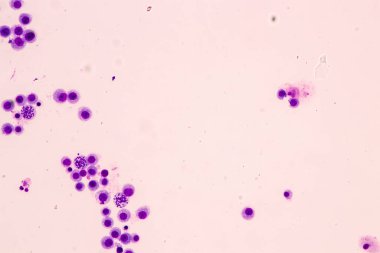 Kromozomlar Eğitim için mikroskop altında İnsan.