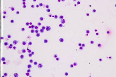 Kromozomlar Eğitim için mikroskop altında İnsan.