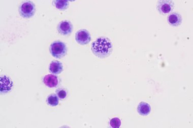 Kromozomlar Eğitim için mikroskop altında İnsan.