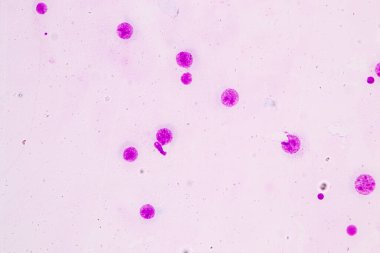 Kromozomlar Eğitim için mikroskop altında İnsan.