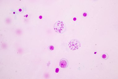 Kromozomlar Eğitim için mikroskop altında İnsan.