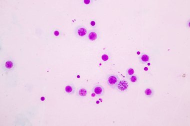 Kromozomlar Eğitim için mikroskop altında İnsan.