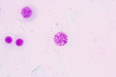 Kromozomlar Eğitim için mikroskop altında İnsan.