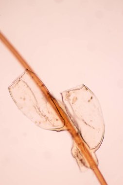 Baş biti (Pediculus humanus capitis), bir parazittir..