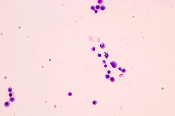 Cromosomas Humanos Bajo Microscopio Para Educación —  Fotos de Stock