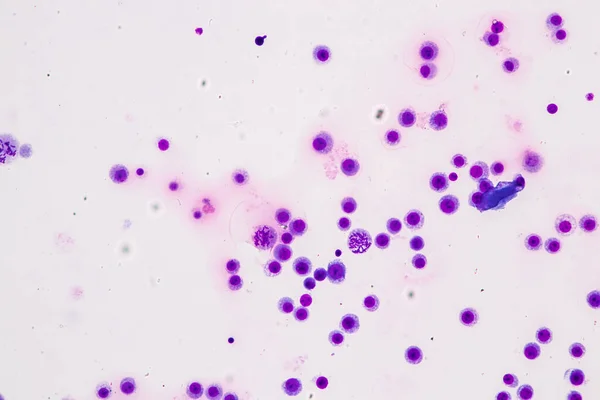 Cromosomi Umani Microscopio Educazione — Foto Stock