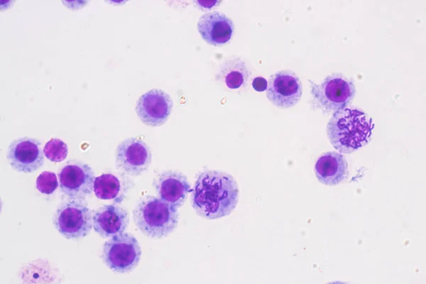 Cromossomas Humano Sob Microscópio Para Educação — Fotografia de Stock