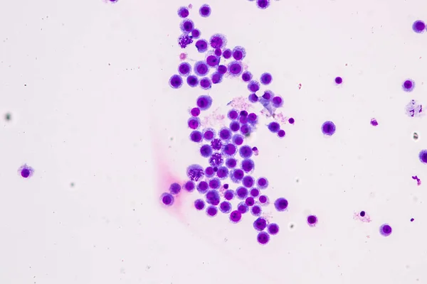 Cromossomas Humano Sob Microscópio Para Educação — Fotografia de Stock