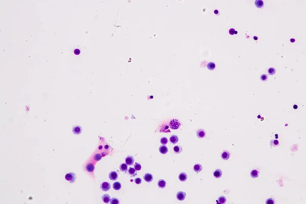 Chromosomy Ludzkie Pod Mikroskopem Edukacji — Zdjęcie stockowe