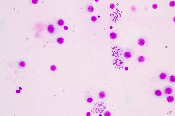 Cromosomas Humanos Bajo Microscopio Para Educación — Foto de Stock