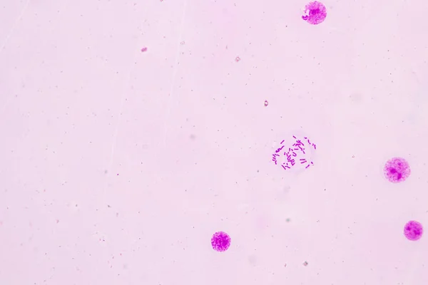 Cromosomi Umani Microscopio Educazione — Foto Stock