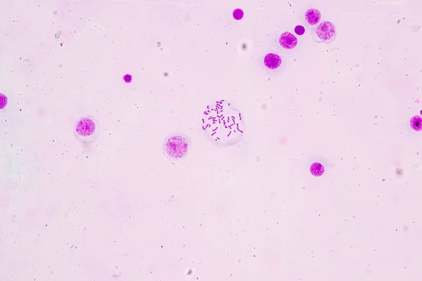 Chromosomen Mens Onder Microscoop Voor Onderwijs — Stockfoto