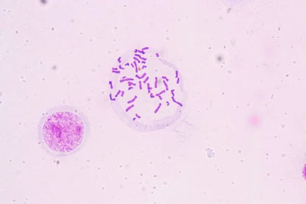 Cromosomi Umani Microscopio Educazione — Foto Stock