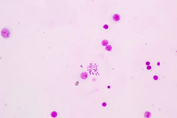 Kromosomer Människa Mikroskop För Utbildning — Stockfoto