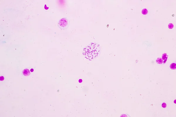 Cromosomas Humanos Bajo Microscopio Para Educación — Foto de Stock