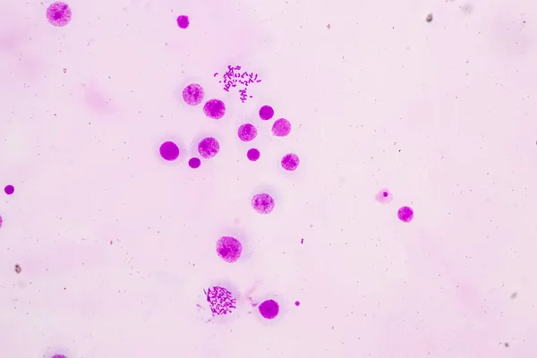 Хромосомы Человека Микроскопом Образования — стоковое фото