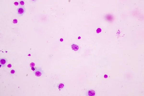Cromosomas Humanos Bajo Microscopio Para Educación —  Fotos de Stock