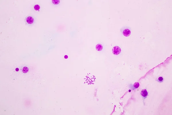 Kromoszómák Emberi Oktatás Mikroszkópja Alatt — Stock Fotó