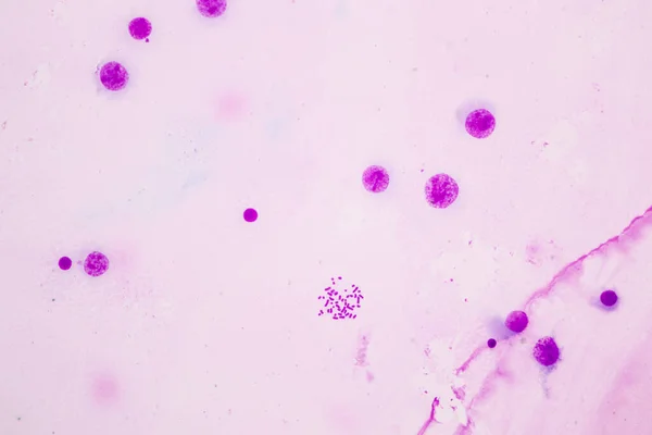 Cromosomi Umani Microscopio Educazione — Foto Stock