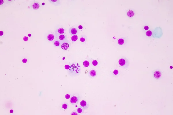 Cromosomas Humanos Bajo Microscopio Para Educación —  Fotos de Stock