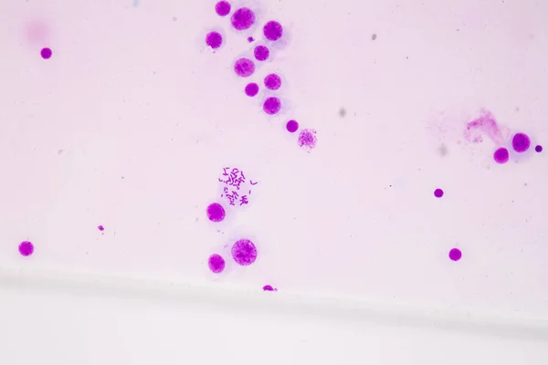 教育用顕微鏡下の染色体人間 — ストック写真