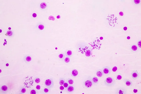 Cromosomi Umani Microscopio Educazione — Foto Stock