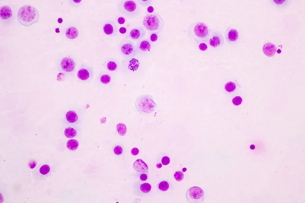 Chromosomen Mens Onder Microscoop Voor Onderwijs — Stockfoto