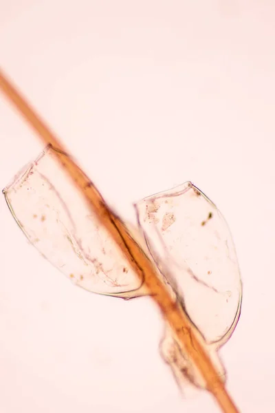 Pidocchio Pediculus Humanus Capitis Parassita Vivi Sul Corpo Sulla Persona — Foto Stock