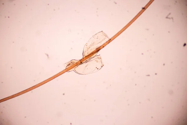 頭の家 Pediculus Humanus Capitis は寄生虫です体 人または動物に生き 食べ物に血を吸うことによって生きる — ストック写真