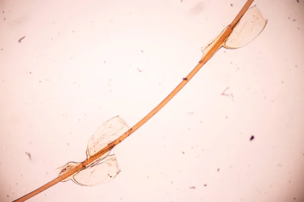 Pidocchio Pediculus Humanus Capitis Parassita Vivi Sul Corpo Sulla Persona — Foto Stock